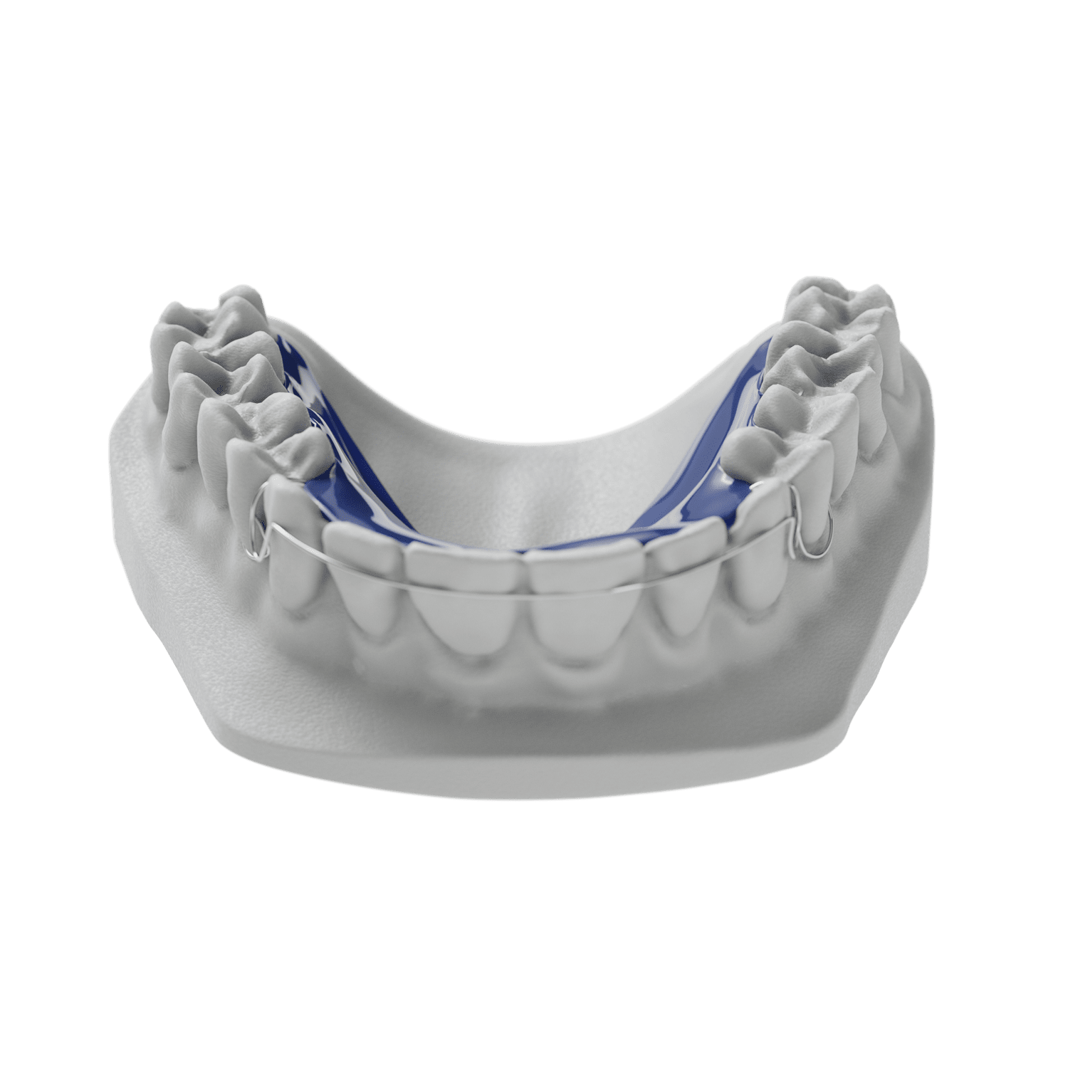 Hawley With Welded C Clasps ODL Orthodontic Labs