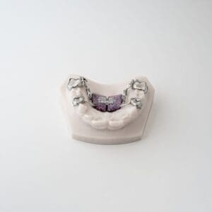 Distal Jet V2 3