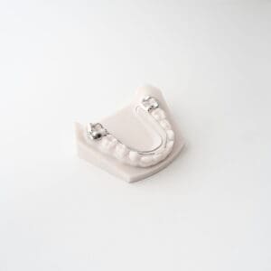 Frozat (Lower W Arch) 4