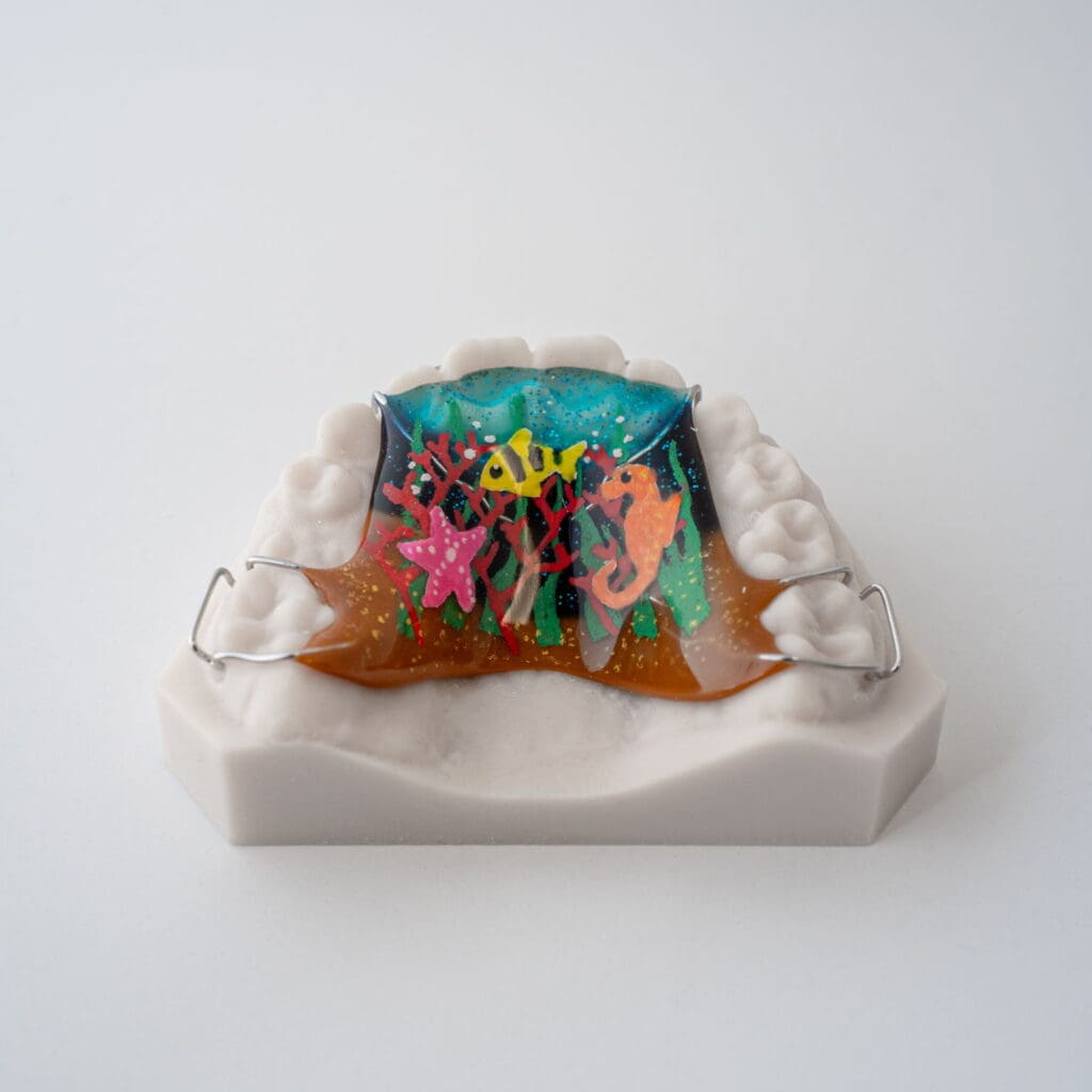 Hawley Phase 1 Retainer 2 (1)
