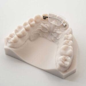 ODL-products-Lingual Bonded Retainer 1 sq