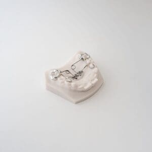 MDA (Mini Distalizing Appliance) 3