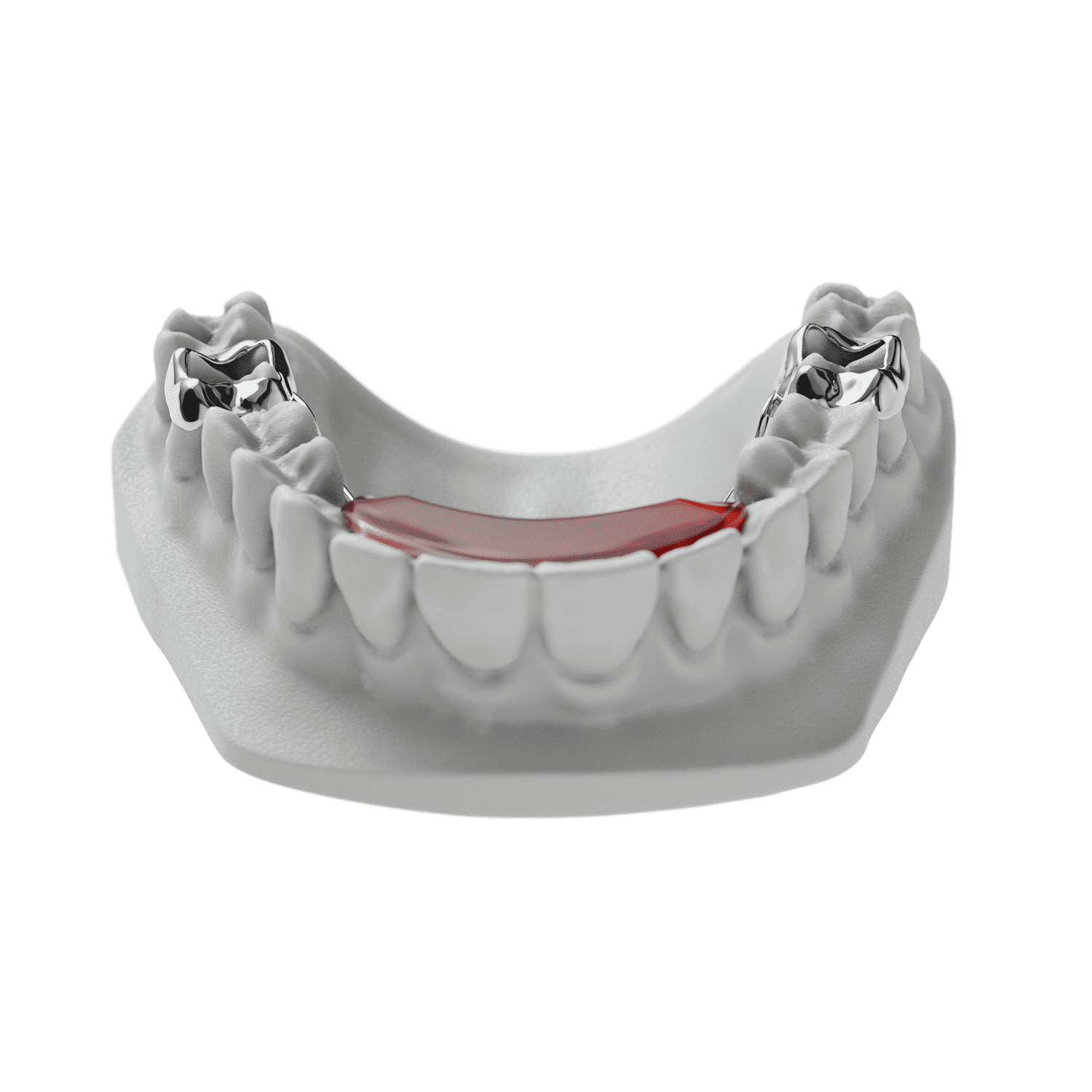 Fixed Bite Plate | ODL Orthodontic Labs