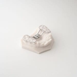 ODL Products 2024 Bonded RPE (Rapid Palatal Expander) 4