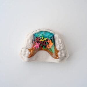 ODL Products 2024 Hawley Phase 1 Retainer 1