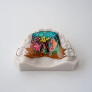 ODL Products 2024 Hawley Phase 1 Retainer 2