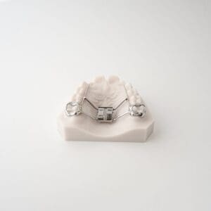 ODL Products 2024 Leaf Spring SELF Activated Expander 2