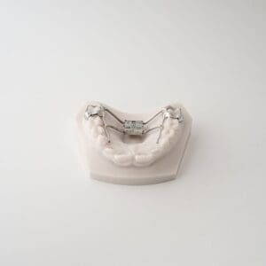 ODL Products 2024 Leaf Spring SELF Activated Expander 3