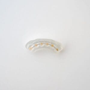 ODL Products 2024 Lingual Bonded Retainer w Custom Pads and Transfer Tray 3