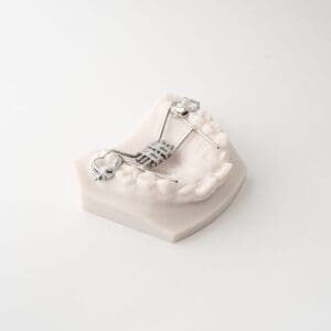 ODL Products 2024 Rapid Palatal Expander (RPE) 3