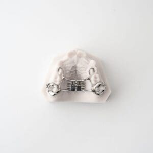 ODL Products 2024 Rapid Palatal Expander (RPE) V2 1