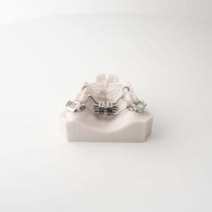 ODL Products 2024 Rapid Palatal Expander (RPE) V2 2