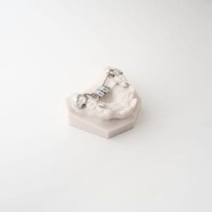 ODL Products 2024 Rapid Palatal Expander (RPE) V2 3