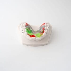 ODL Products 2024 Saggital Appliance 3