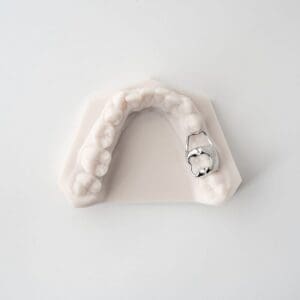 ODL Products 2024 Space Maintainer (Band and Loop) 1