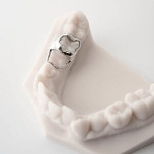 ODL Products 2024 Space Maintainer (Band and Loop) 2