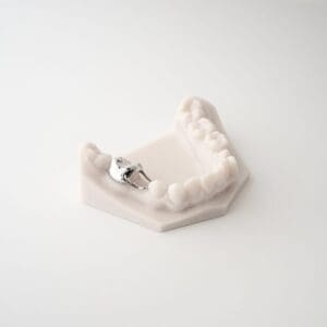 ODL Products 2024 Space Maintainer (Band and Loop) 4