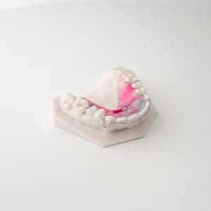 ODL Products 2024 Super Spring Aligner 4