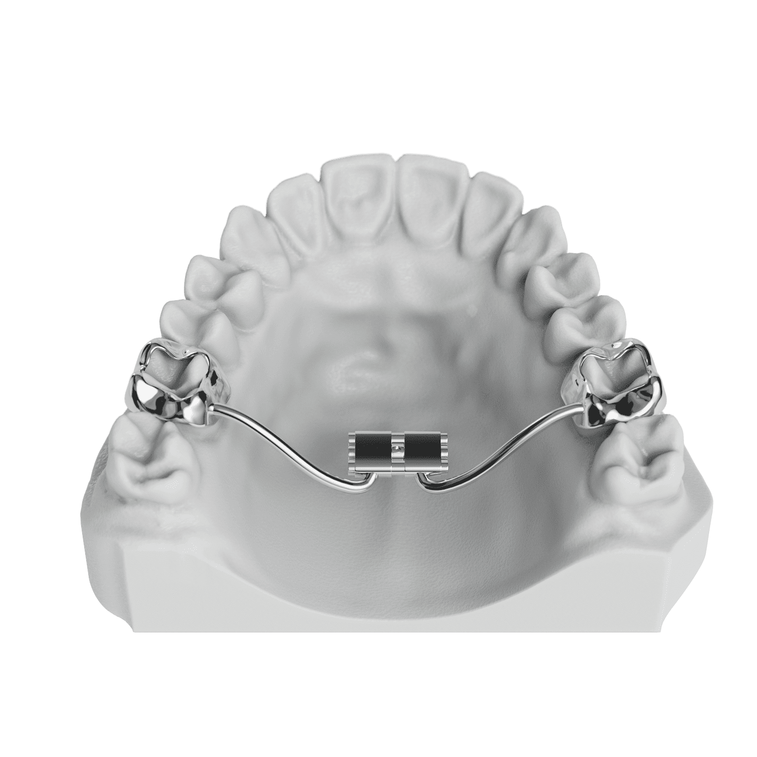 Snap Lock RPE | ODL Orthodontic Labs