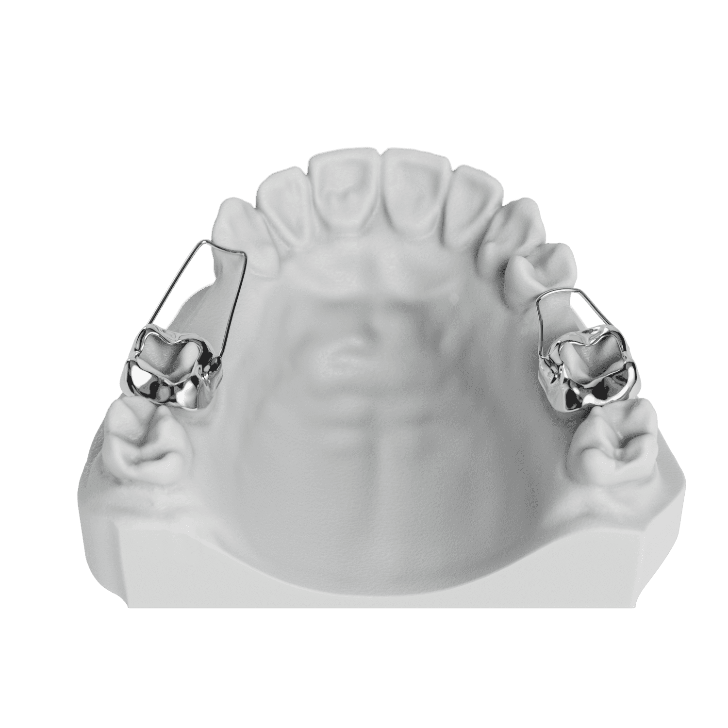 Space Maintainer ODL Orthodontic Labs