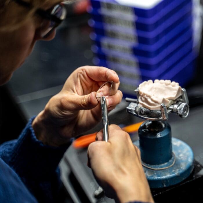 HardSoft Splint / Nightguard ODL Orthodontic Labs