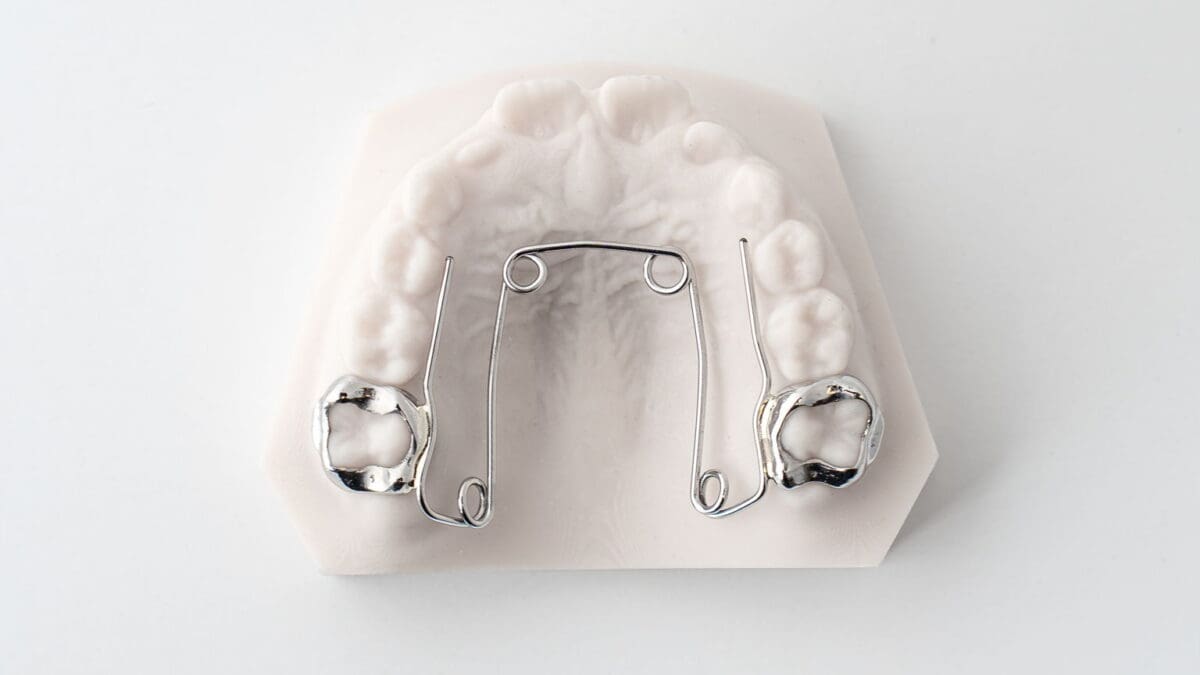 Quad Helix | ODL Orthodontic Labs