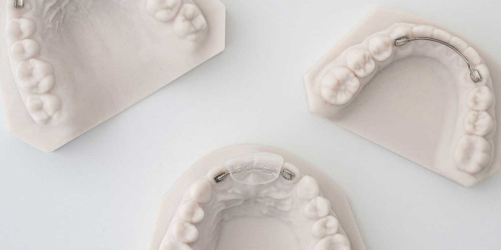 ODL-products-Lingual Bonded Retainer 3 sq