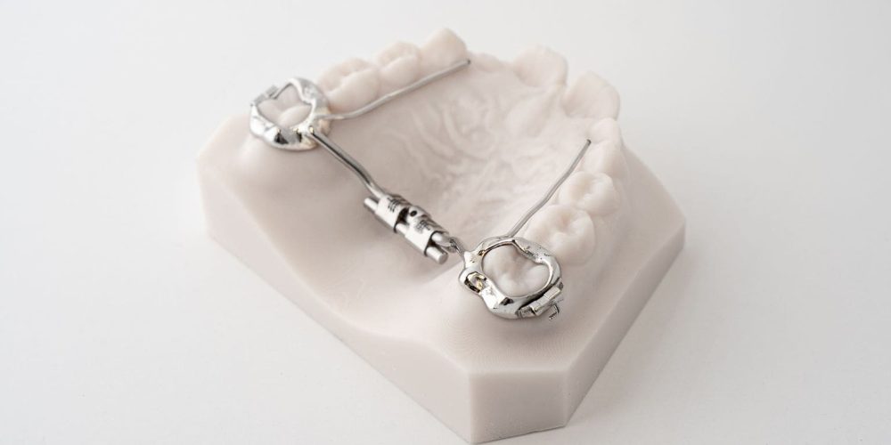odl ortho Rapid Palatal Expanders Compact RPE 3