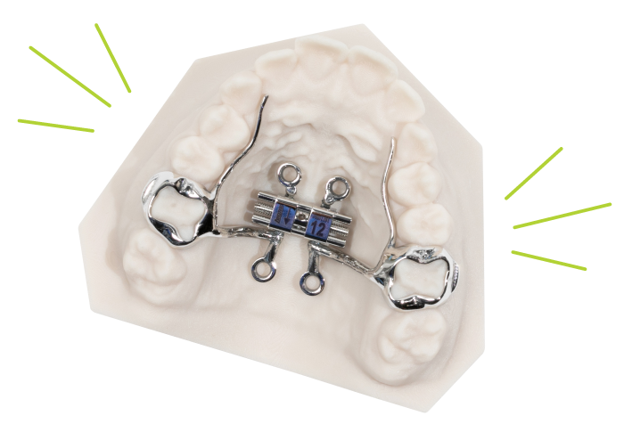 odl appliance cut out marpe