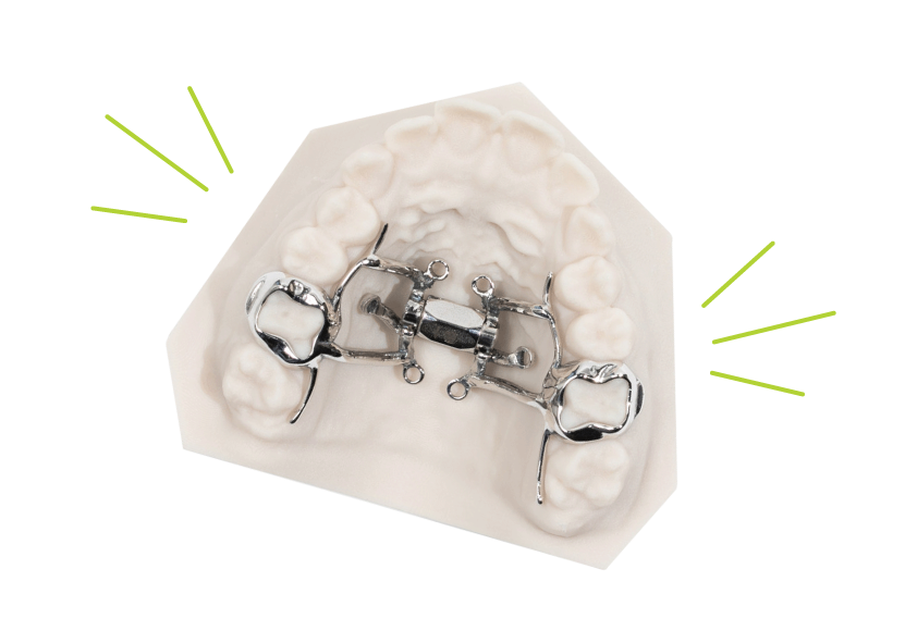 odl appliance cut out power screw