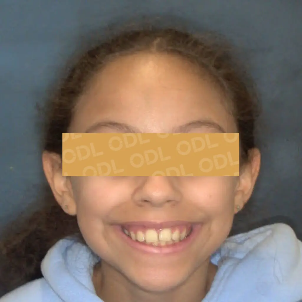 odl casper patient 2 after