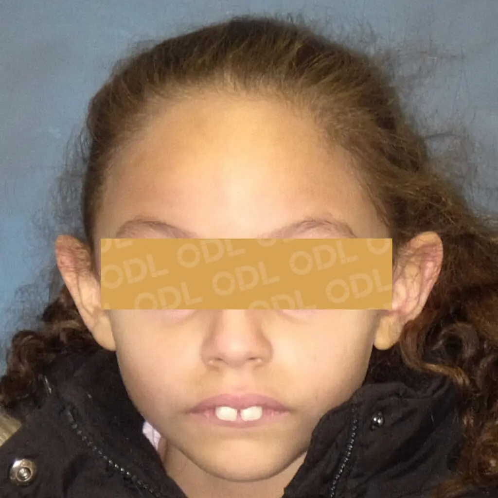 odl casper patient 2 before