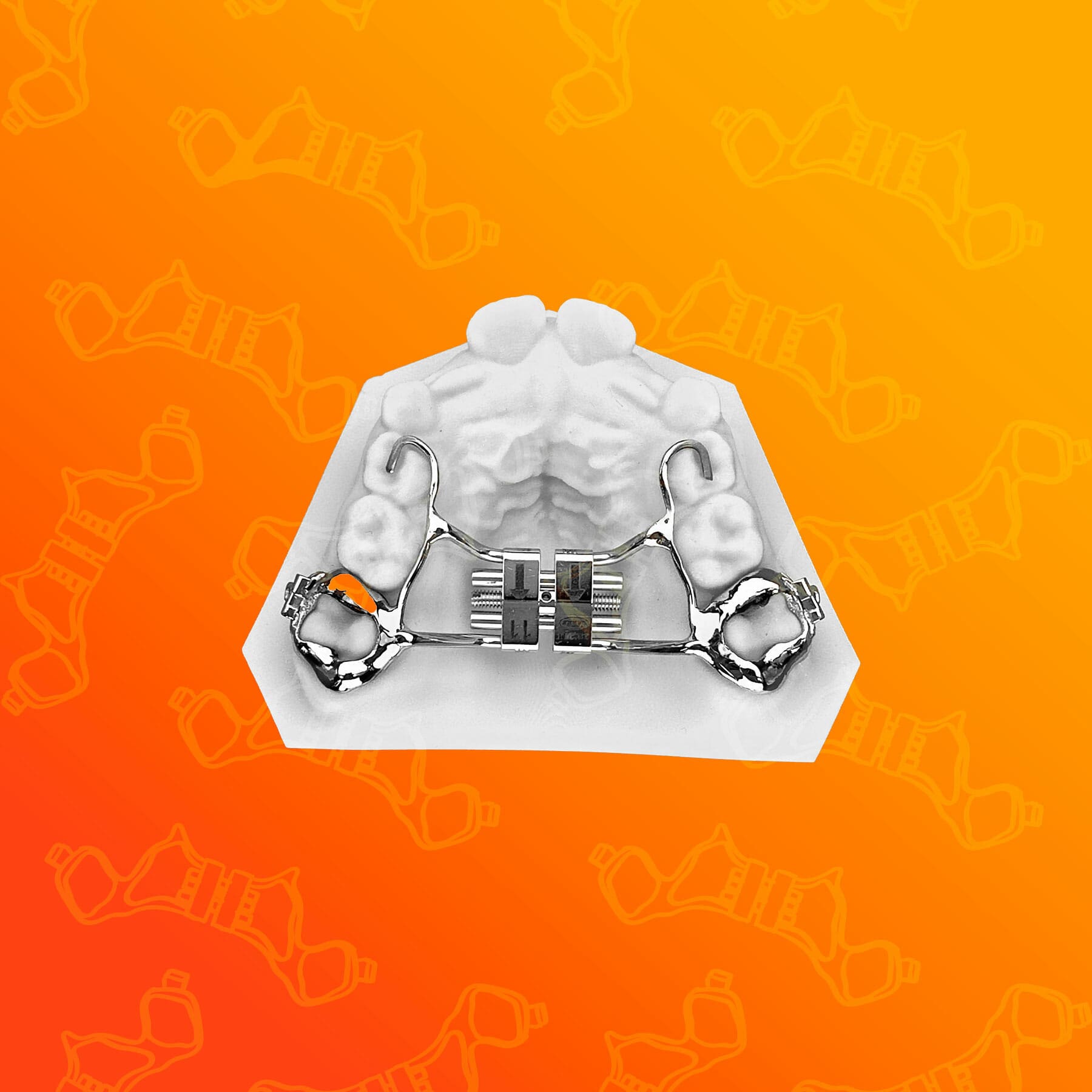 Narrow Rpe Infinity RPE | Innovative 3D-Printed Rapid Palatal Expanders